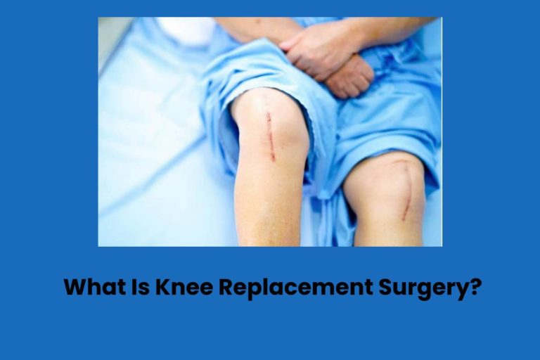 What Is Knee Replacement Surgery?