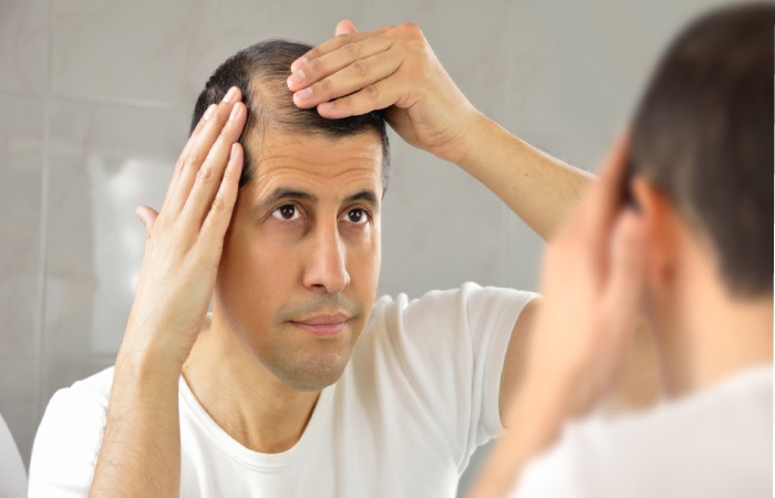 most common reasons for hair loss
