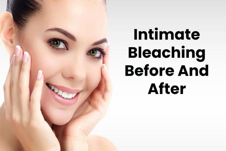 Intimate Bleaching Before And After