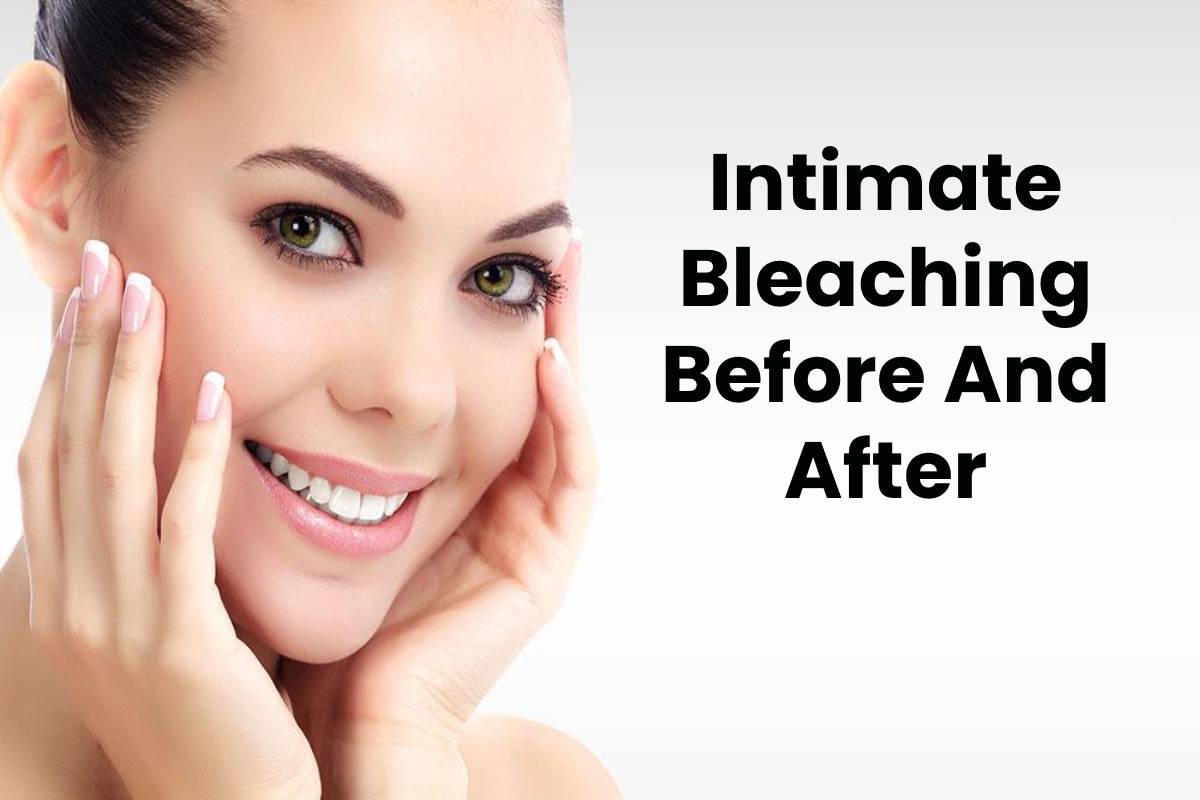 Intimate Bleaching Laser Before And After