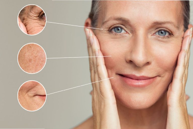 14 Ways to Help Avoid Face Wrinkles