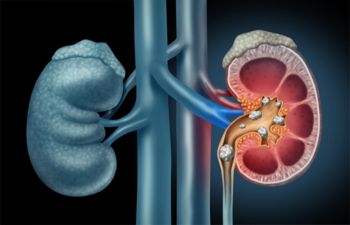Wellhealthorganic.Com:Some-Amazing-Health-Benefits-Of-Drinking-Water-From-An-Earthen-Pot
