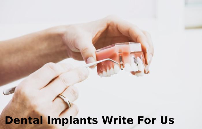 Dental Implants Write For Us