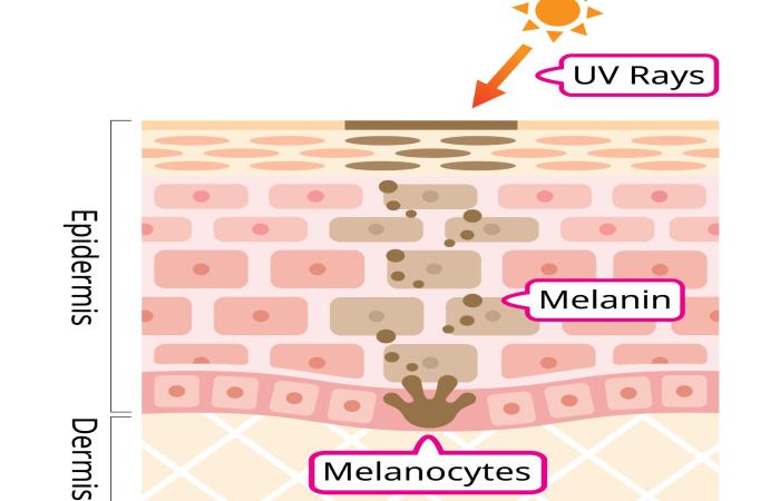 causes of intimate area darkening infographic