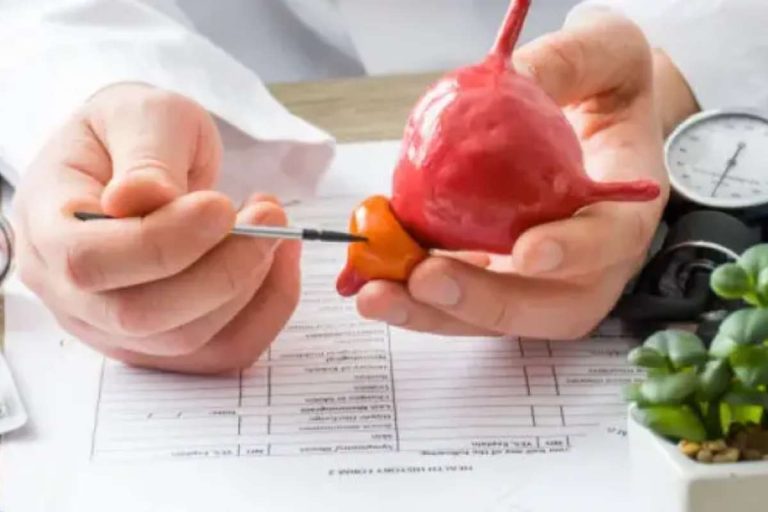 Why Do Prostate Issues Become More Common With Age? Understanding the Causes and Risk Factors