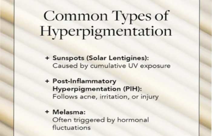 why summer triggers hyperpigmentation